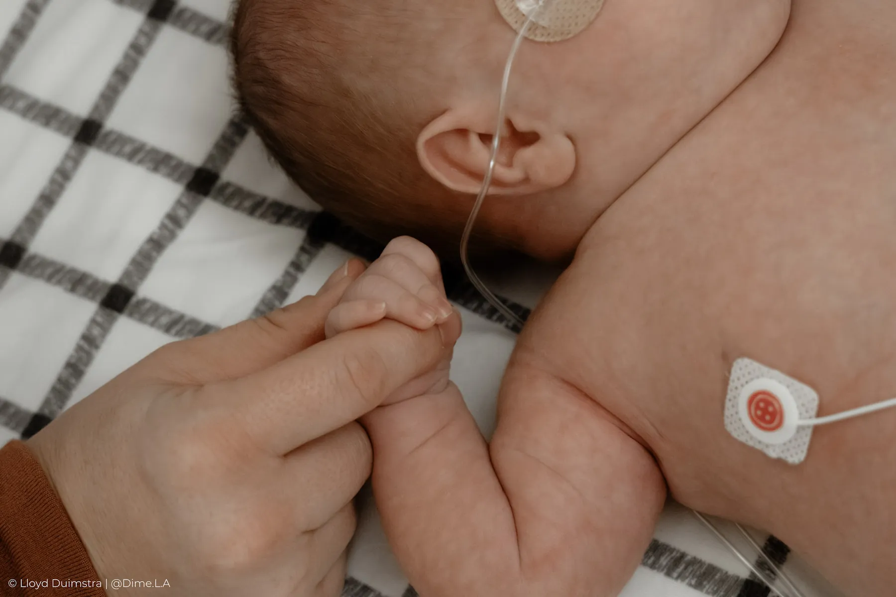 Newborn fingers wrapped around a parent’s hand, NICU detail